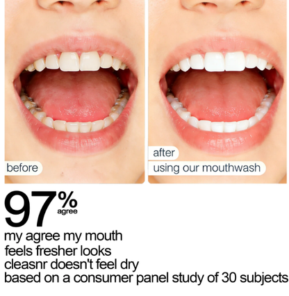 ✨ SEATLIKE Stain Whitening   Mouthwash 🌿 |Say Goodbye to Surface Stains and Hello to a Brighter Smile-9SLL