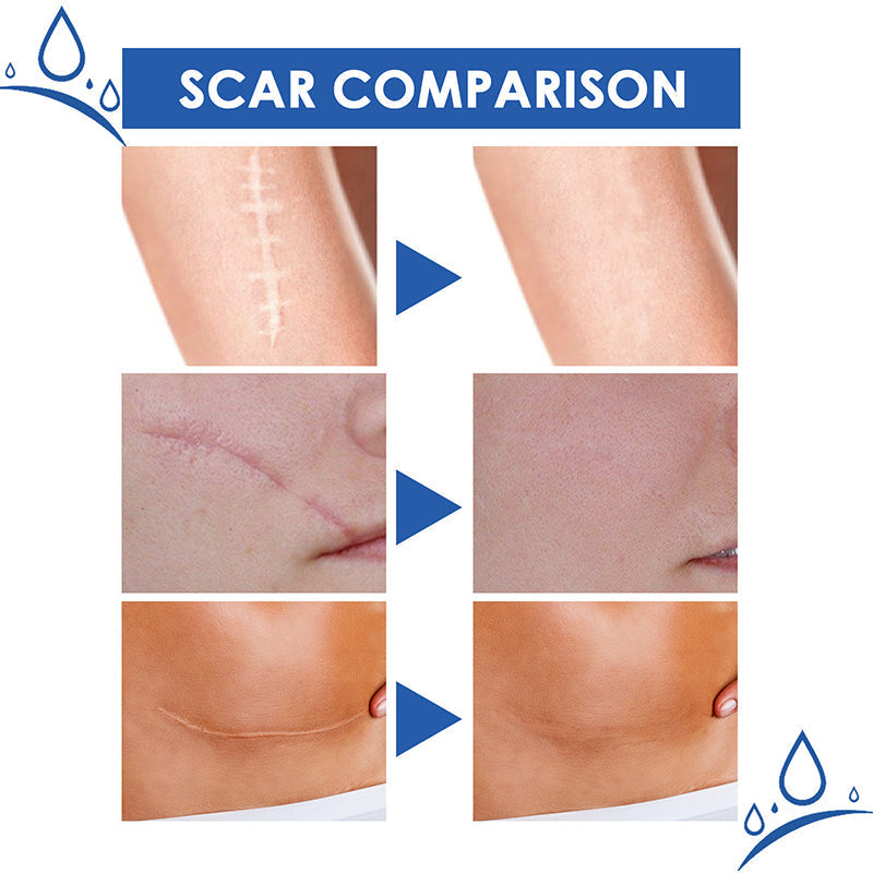 Final 3 Hours: 60%OFF🔥 DEA™ Scar Repair Cream for Men and Women, fade scars and tighten skin in one step