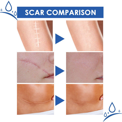 Final 3 Hours: 60%OFF🔥 DEA™ Scar Repair Cream for Men and Women, fade scars and tighten skin in one step