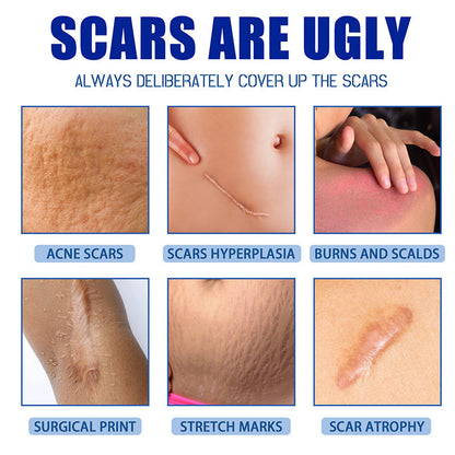 Final 3 Hours: 60%OFF🔥 DEA™ Scar Repair Cream for Men and Women, fade scars and tighten skin in one step